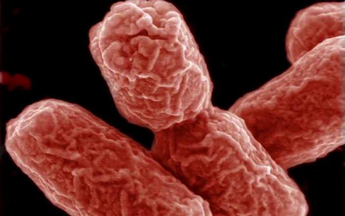 E. coli aparţine unei familii de bacterii rezistentă la antibiotice FOTO AFP