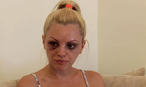 Alexandra Stan a fost bătută crunt de fostul impresar, Marcel Prodan jpeg