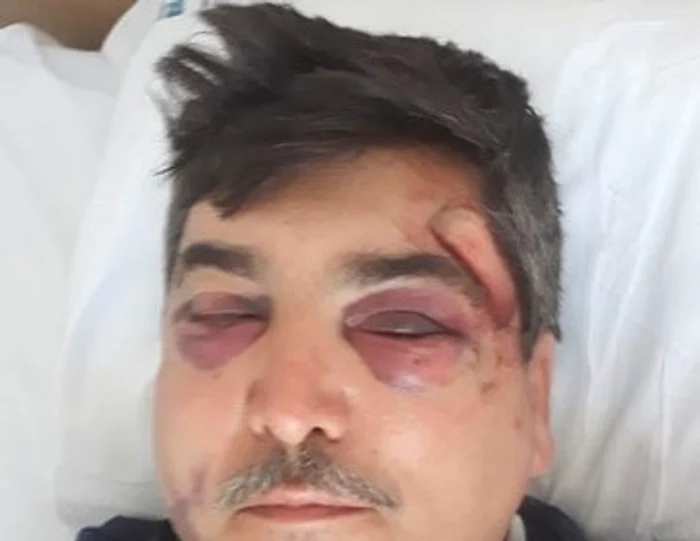 Șoferul rănit a fost transferat la o clinică din Capitală