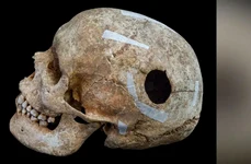 Gaura ovală avea o dimensiune de 3 cm, iar testele inițiale cu radiocarbon sugerează că bărbatul a trăit între anii 772 și 891 d.Hr. (© Cambridge Archaeological Unit / David Matzliach)