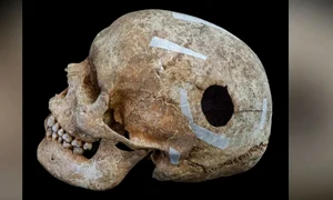 Gaura ovală avea o dimensiune de 3 cm, iar testele inițiale cu radiocarbon sugerează că bărbatul a trăit între anii 772 și 891 d.Hr. (© Cambridge Archaeological Unit / David Matzliach)