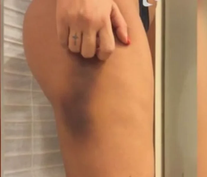 Simona a arătat la tv ce a păţit după ce a căzut peste masa plină de pahare