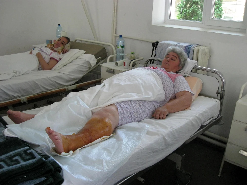 Vârstnicii sunt cei mai predispuşi să dezvolte suprainfecţii