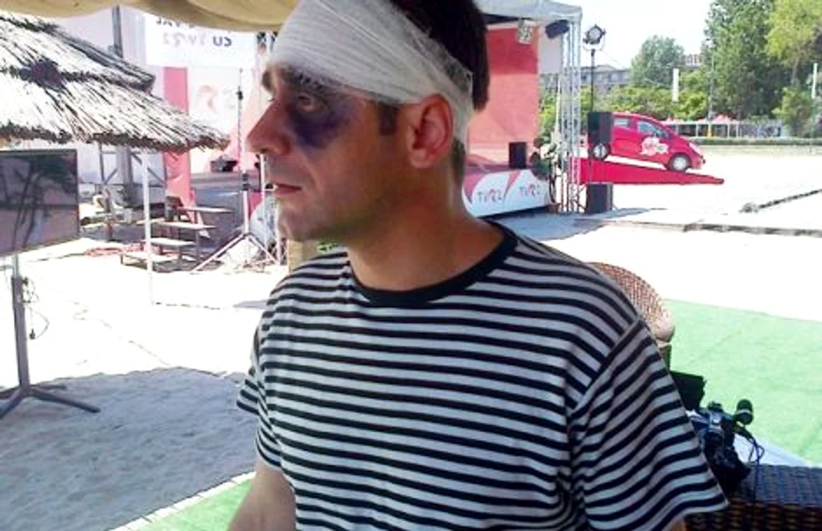 FOTO Gabriel Fătu, cu un ochi vânăt şi pansat la cap. Ce a păţit actorul?