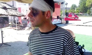 FOTO Gabriel Fătu, cu un ochi vânăt şi pansat la cap  Ce a păţit actorul? jpeg