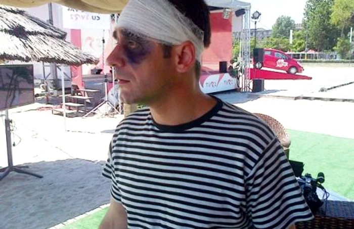 FOTO Gabriel Fătu, cu un ochi vânăt şi pansat la cap. Ce a păţit actorul?