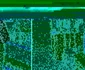 complex persoane cu handicap barlad