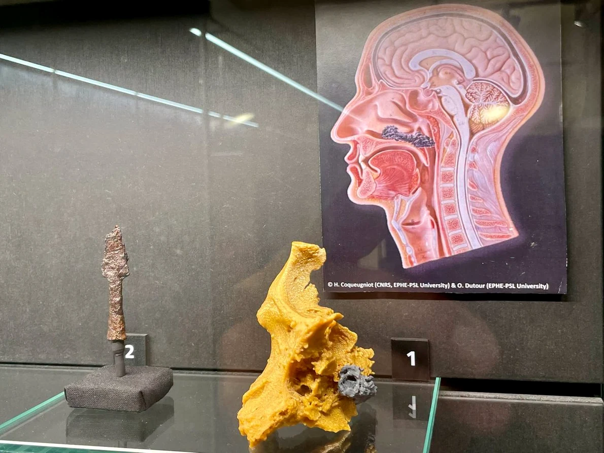 Muzeul de Istorie și Arheologie din cadrul Muzeului Județean Mureș găzduiește expoziția „EPIDEMIX. Epidemii, afecțiuni și practici de vindecare din preistorie până în secolul al XVI-lea”