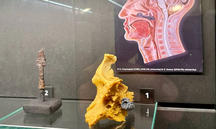 Muzeul de Istorie și Arheologie din cadrul Muzeului Județean Mureș găzduiește expoziția „EPIDEMIX. Epidemii, afecțiuni și practici de vindecare din preistorie până în secolul al XVI-lea”