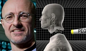 primul transplant de cap jpeg