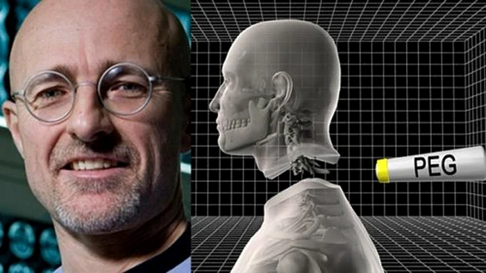 
    primul transplant de cap  