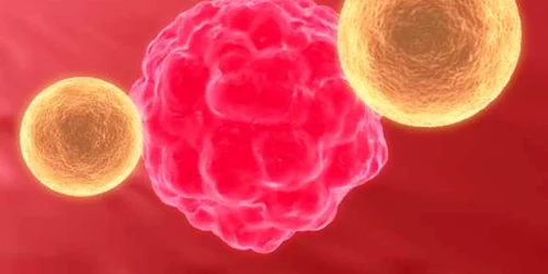 Apariţia celulelor tumorale în organism este favorizată de alimentaţia modernă, dezechilibrată