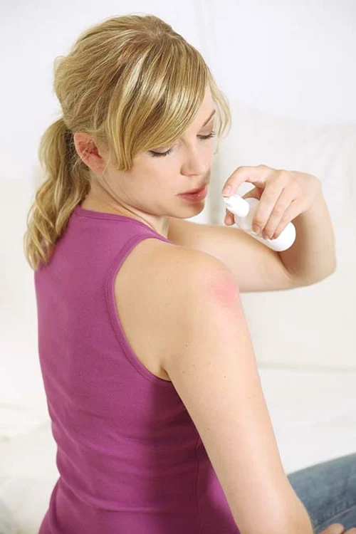 
    Spray-urile  speciale te ajută  să scapi de înţepături  