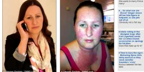 Femeii i-au fost descoperite 13 alergii