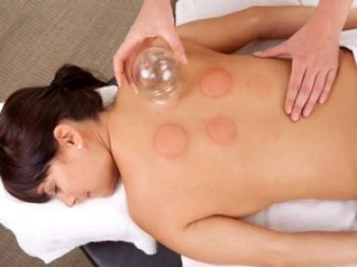 
    Tratarea răcelii cu ventuze: Tot ce trebuie să ştii despre această terapiefoto: clicksănătate.ro  