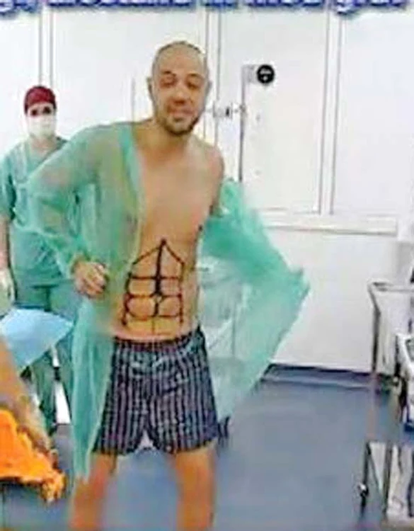 Mihai Mitoşeru a scăpat de cearcăne şi de burtă. În iunie 2012, prezentatorul tv Mi- hai Mitoşeru şi-a luat inima în dinţi şi a apelat la liposucţie abdominală. Dar înainte de asta, în 2009, Mitoşeru a scăpat şi de cearcăne prin metoda chirurgicală nu