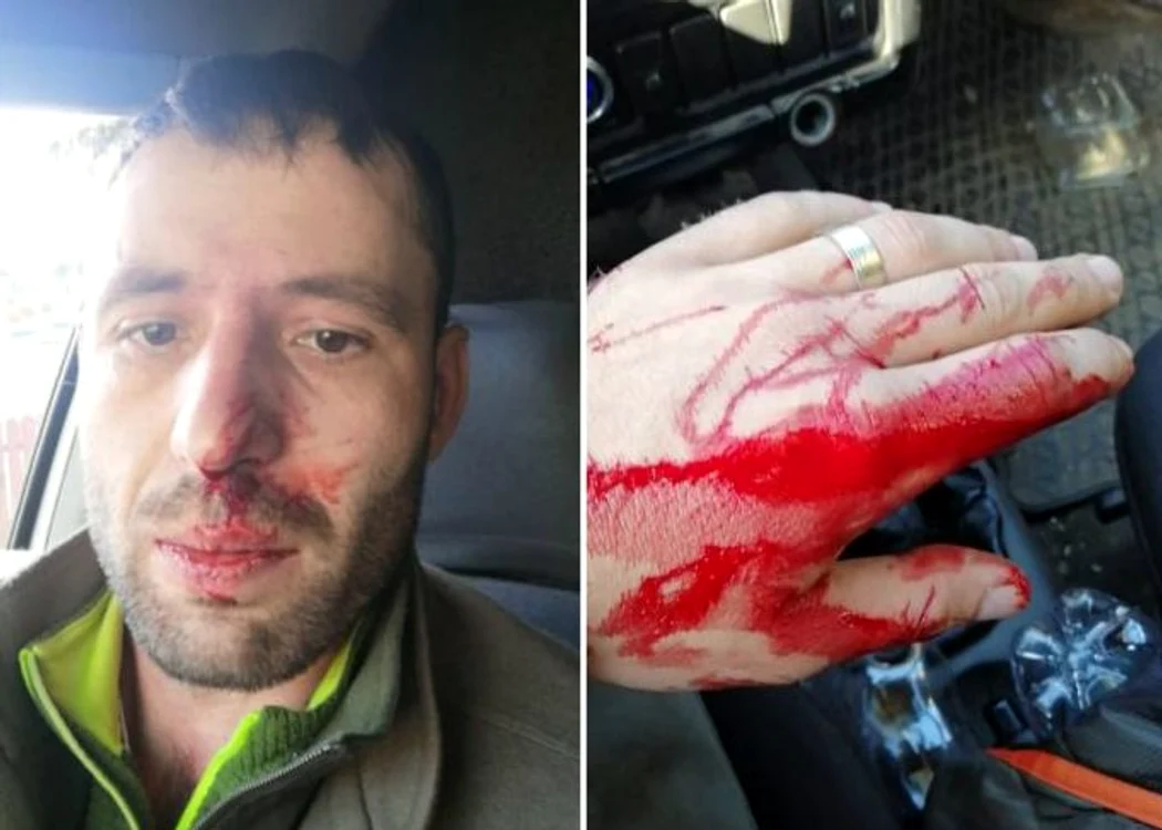 
    Un pădurar a fost bătut și amenințat cu moartea, după ce a oferit câteva informații despre mafia lemnului unor jurnaliștiFoto: Recorder  