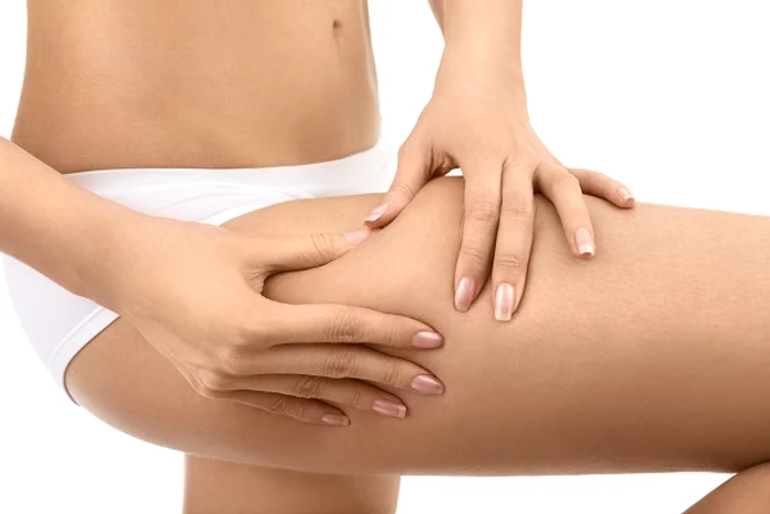 Celulita și depozitele de grăsime se pot elimina rapid prin liposucțieCelulita și depozitele de grăsime se pot elimina rapid prin liposucție
