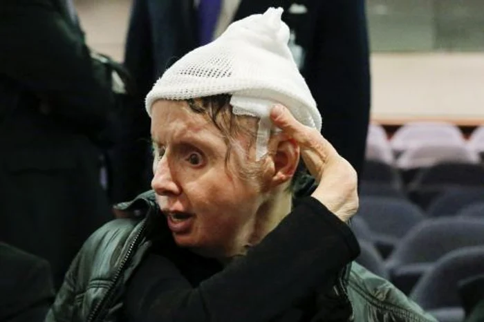 Charla Nash (FOTO REUTERS)