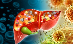 e1112a509cc7882cc7e6eb8f7a53f22aaa jpg