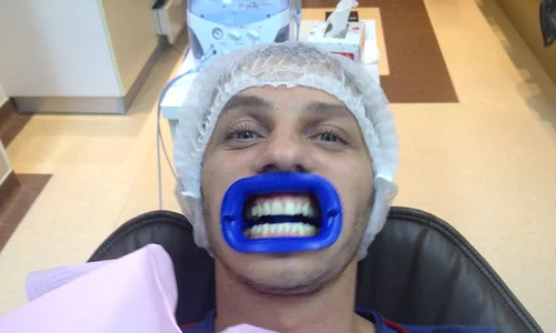 Mihai Trăistariu şi a albit dinţii la clinica Radius Dent jpeg