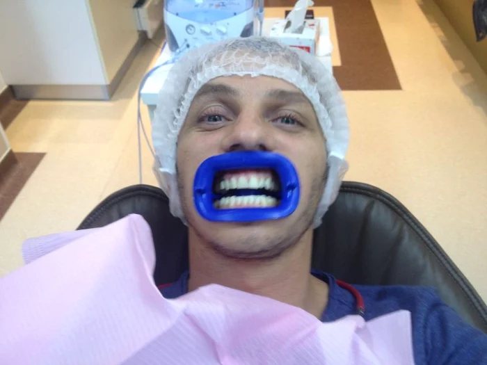 Mihai Trăistariu şi-a albit dinţii la clinica Radius Dent