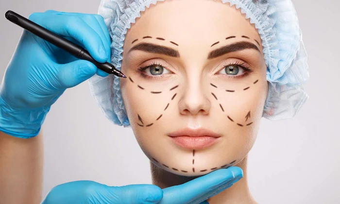 chirurgie estetica
