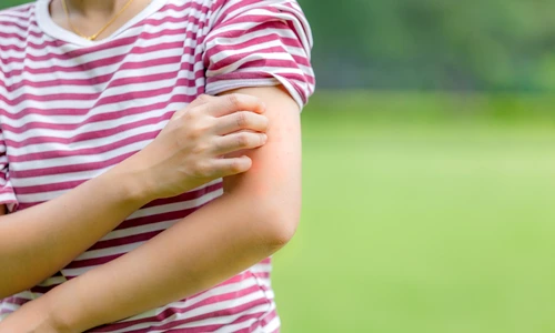 Muscaturi de tantari  jpg