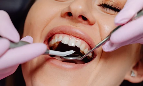 5 curiozități despre dinți pe care nu le știai jpeg