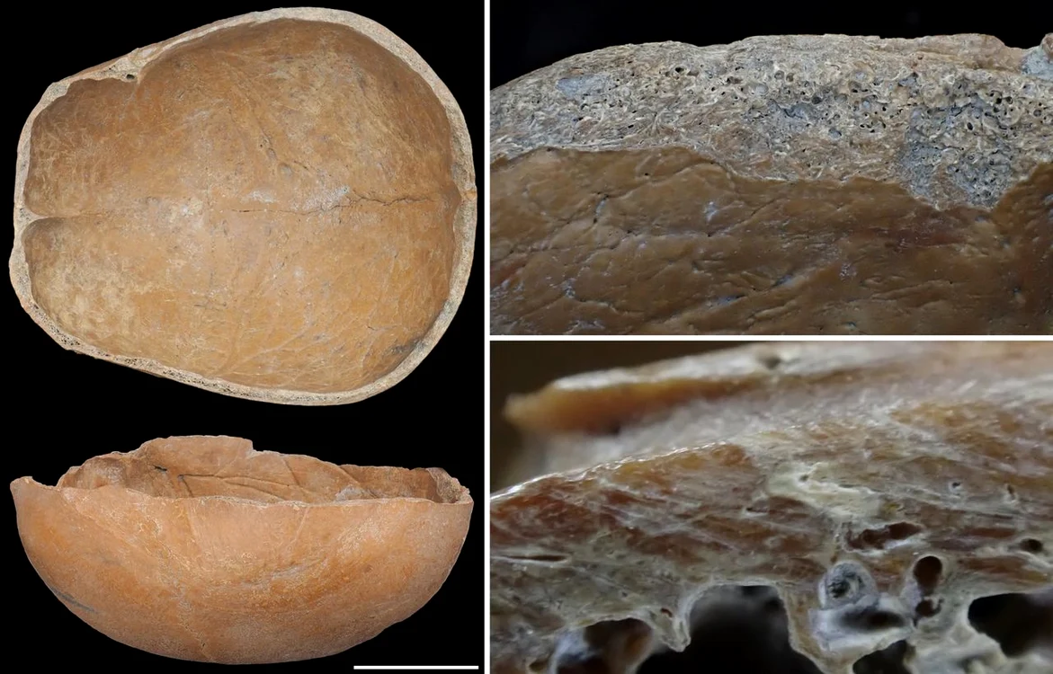 Foto: © Sawada et al., Scientific Reports (CC BY 4.0)