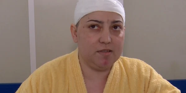  Pacienta Vera Baranic png