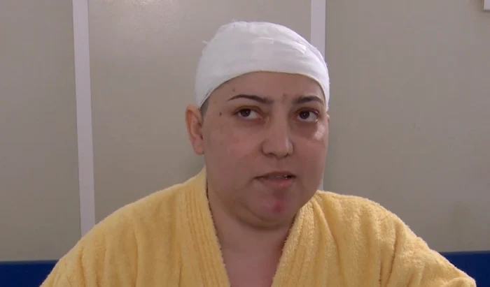 Pacienta Vera Baranic   Sursa foto: Arhiva Spitalului de Neurochirurgie din Iasi