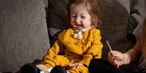 Isla Kilpatrick Screatonfetita care seufera de boala Benjamin Button FOTO Profimedia
