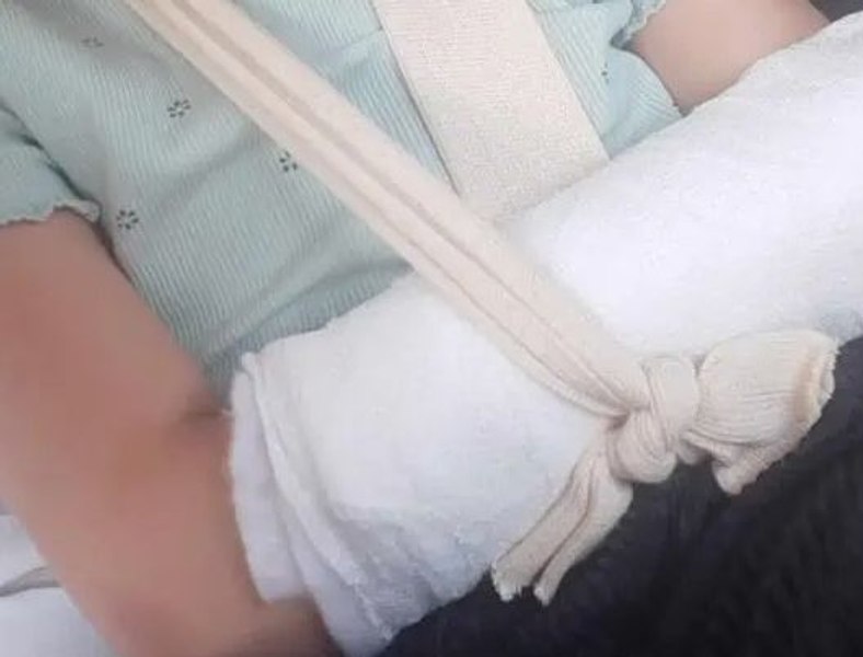 Tratament cu unguent pentru o mână ruptă. Asta au prescris unei fetițe medicii de la spitalul din Alba Iulia