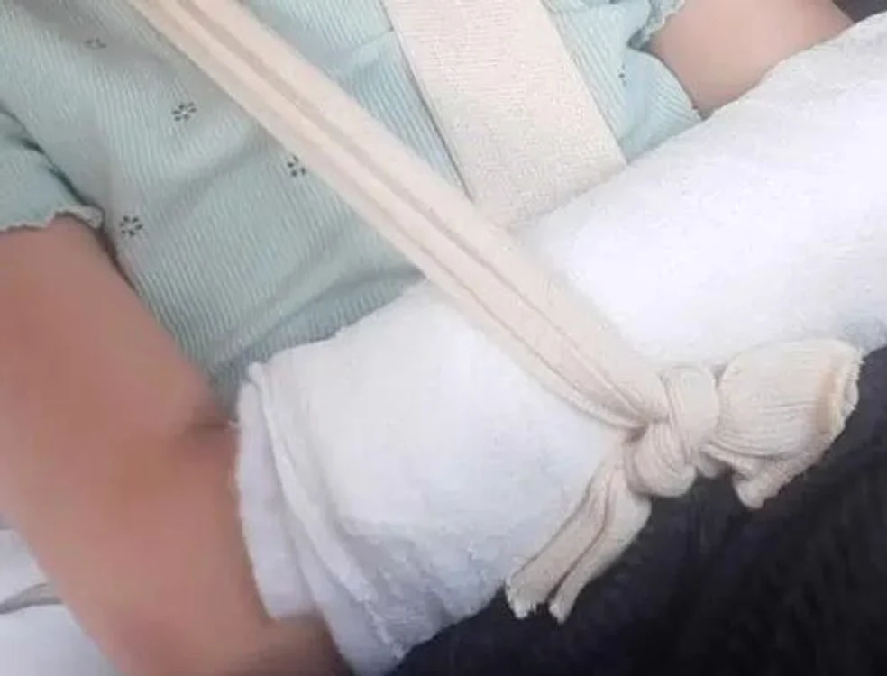 Fetița va sta cu mâna în gips timp de trei săptămâni FOTO alba24.ro