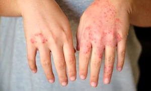 e1b212bcc6134f739c148e9c7d32bf216a jpg