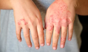 e1b212bcc6134f739c148e9c7d32bf216a jpg