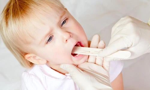 Roşu în gât la copii  Cauze, simptome şi tratament jpeg