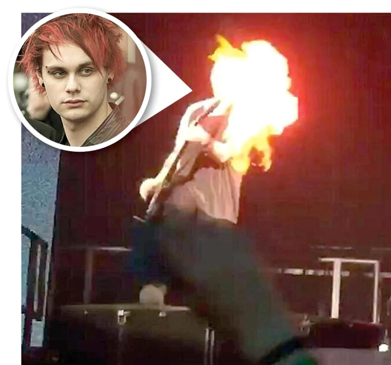 Michael Clifford  a suferit arsuri  serioase pe faţă