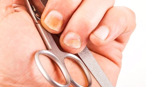 1 ciuperca unghiei simptome si tratament jpg jpeg