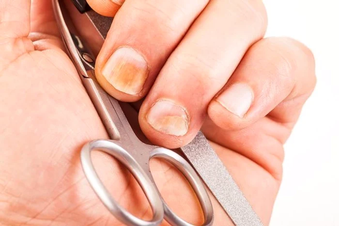 1 ciuperca unghiei simptome si tratament jpg jpeg