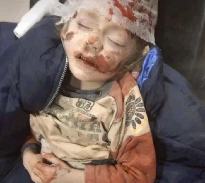 Un băiețel a căzut victimă bombardamentelor lui Vladimir Putin Sursă foto: Parlamentul Ucrainei
