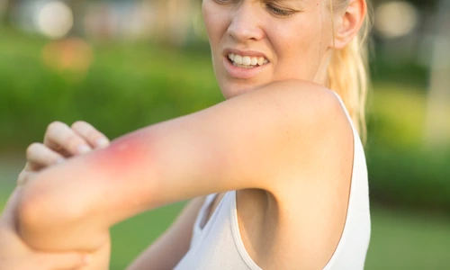 1 muscatura de tantar jpg jpeg