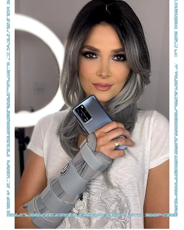 4 alina puscas s a accidentat la mana 1 jpg jpeg