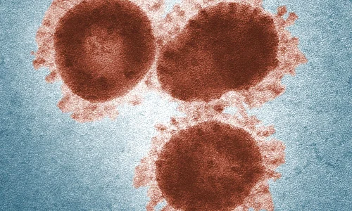 1 coronavirus1 jpg jpeg