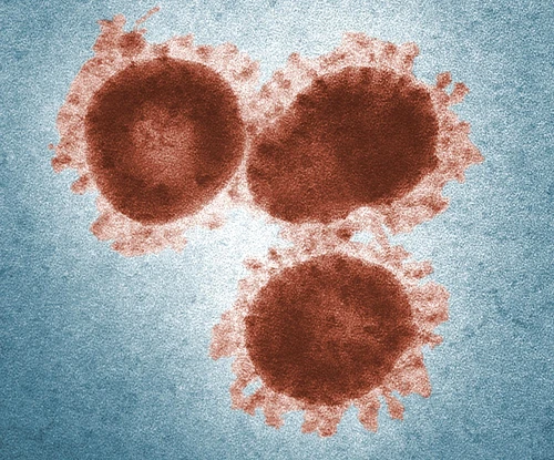 1 coronavirus1 jpg jpeg