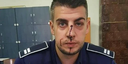 Agentul Sorin Cepoi a fost lovit de un şofer nervos şi băut
