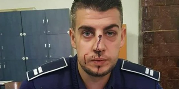  Agentul Sorin Cepoi a fost lovit de un şofer nervos şi băut