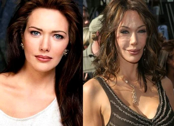 Hunter Tylo, înainte şi după operaţiile estetice