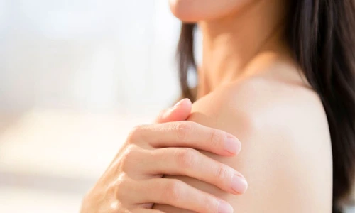 de ce te mănâncă pielea jpeg